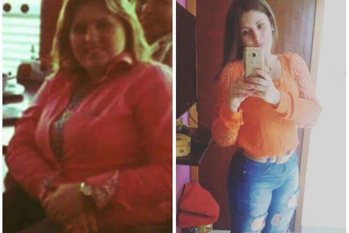 Após superar compulsão alimentar, empresária elimina 32 quilos
