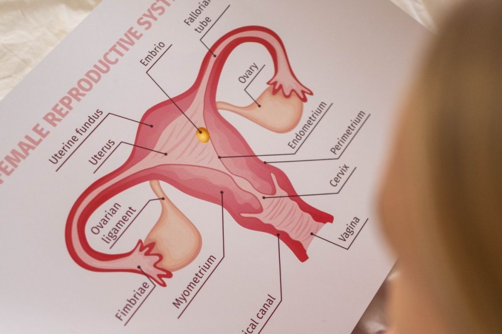 Como a suplementação auxilia quem sofre com endometriose?