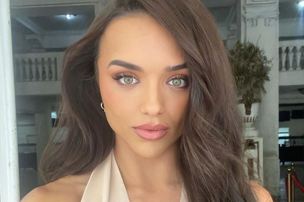 Rafa Kalimann mostra rosto com acnes e diz que problema afetou autoestima