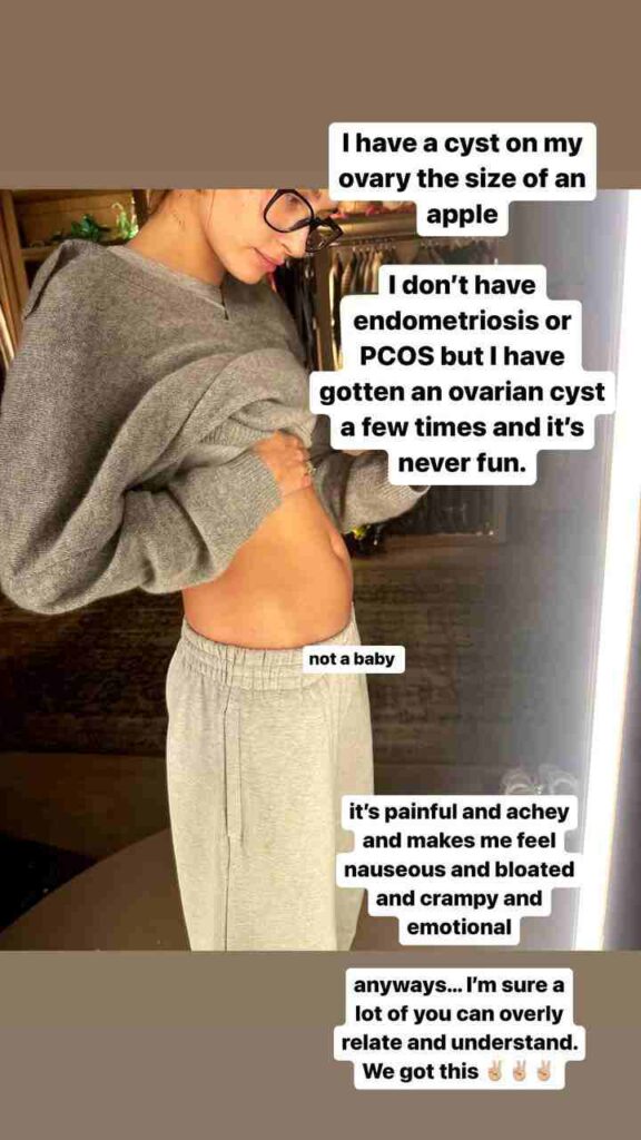 hailey bieber cisto ovariano Hailey Bieber mostrando inchaço na barriga