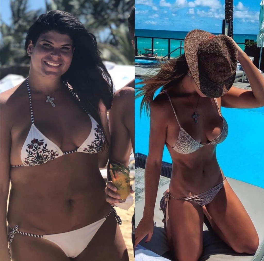 Carol Taurisano antes e depois