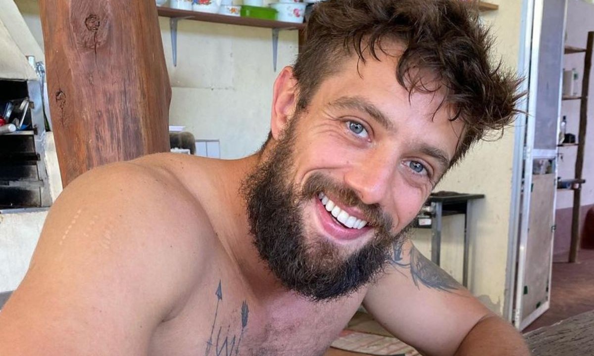 Rafael Cardoso foi diagnosticado com celulite infecciosa