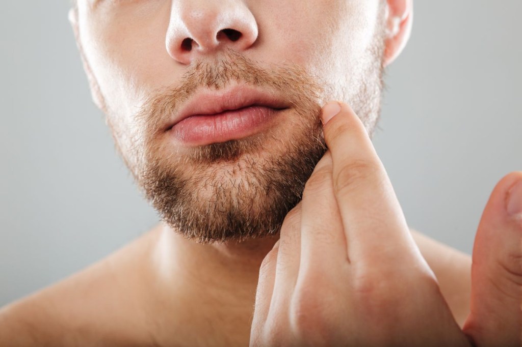 Espinhas na região da barba