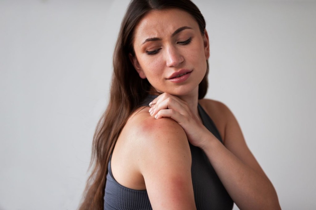 cuidados para evitar a alergia ao sol